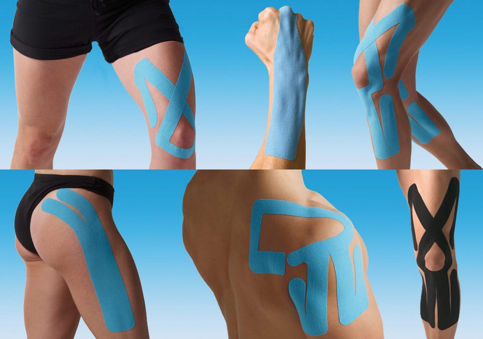 kinesiotape